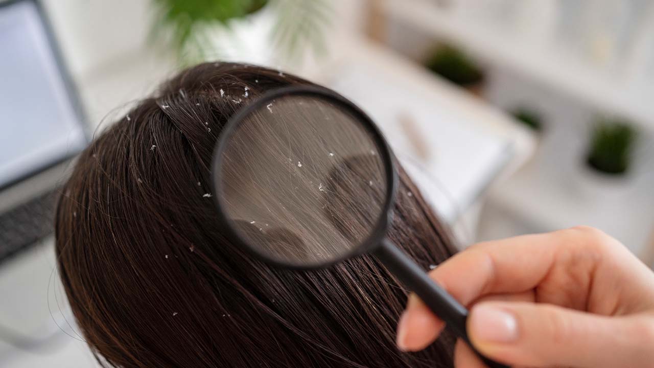 best shampoo for dandruff & hair fall