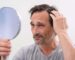 how to prevent hair fall naturally